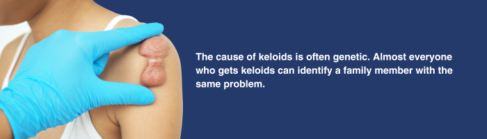 Doctor examining keloid on the shoulder area